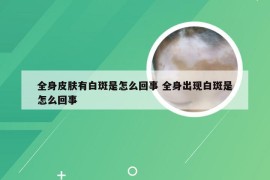 全身皮肤有白斑是怎么回事 全身出现白斑是怎么回事