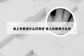 身上长藓涂什么药膏好 身上长癣用什么好