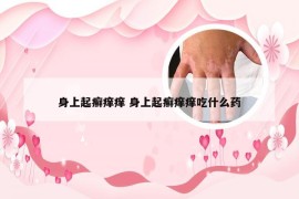 身上起癣痒痒 身上起癣痒痒吃什么药