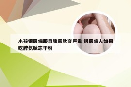 小孩银屑病服用脾氨肽变严重 银屑病人如何吃脾氨肽冻干粉