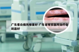 广东看白癜风哪里好 广东省哪家医院治疗白斑最好