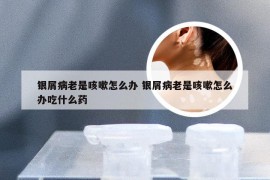 银屑病老是咳嗽怎么办 银屑病老是咳嗽怎么办吃什么药