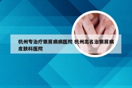 杭州专治疗银屑病病医院 杭州出名治银屑病皮肤科医院