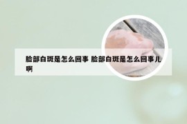 脸部白斑是怎么回事 脸部白斑是怎么回事儿啊