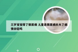 三岁宝宝得了银屑病 儿童患银屑病长大了病情会轻吗