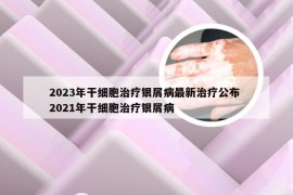 2023年干细胞治疗银屑病最新治疗公布 2021年干细胞治疗银屑病