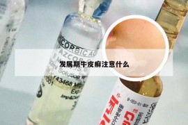 发展期牛皮癣注意什么