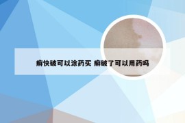 癣快破可以涂药买 癣破了可以用药吗