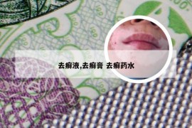 去癣液,去癣膏 去癣药水