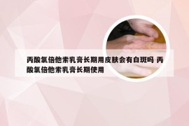 丙酸氯倍他索乳膏长期用皮肤会有白斑吗 丙酸氯倍他索乳膏长期使用