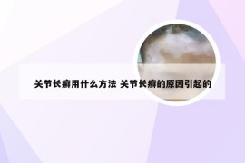 关节长癣用什么方法 关节长癣的原因引起的