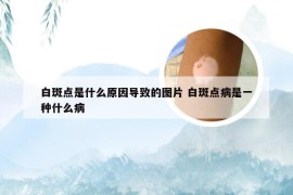 白斑点是什么原因导致的图片 白斑点病是一种什么病