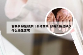 容易长癣是缺少什么维生素 容易长癣是缺少什么维生素呢