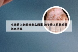 小孩脸上老起癣怎么回事 孩子脸上总起癣是怎么回事