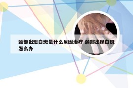 颈部出现白斑是什么原因治疗 颈部出现白斑怎么办