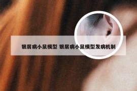 银屑病小鼠模型 银屑病小鼠模型发病机制