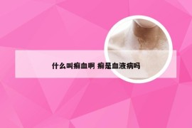 什么叫癣血啊 癣是血液病吗