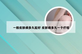 一般皮肤病多久能好 皮肤病多久一个疗程