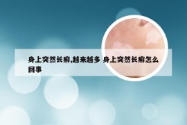 身上突然长癣,越来越多 身上突然长癣怎么回事