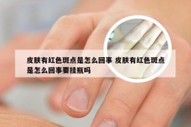 皮肤有红色斑点是怎么回事 皮肤有红色斑点是怎么回事要挂瓶吗