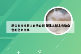 新生儿宝宝腿上有块白斑 新生儿腿上有块白色的怎么回事