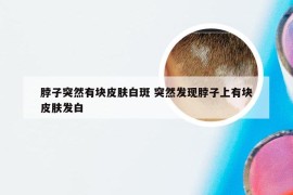 脖子突然有块皮肤白斑 突然发现脖子上有块皮肤发白