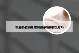 银屑病必须要 银屑病必须要做光疗吗