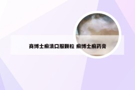 商博士癣清囗服颗粒 癣博士癣药膏