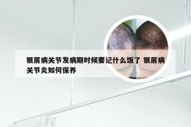 银屑病关节发病期时候要记什么饭了 银屑病关节炎如何保养