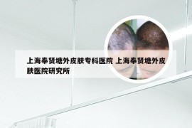 上海奉贤塘外皮肤专科医院 上海奉贤塘外皮肤医院研究所