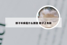 膀子长癣是什么原因 膀子上有藓