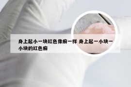 身上起小一块红色像癣一样 身上起一小块一小块的红色癣