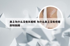 身上为什么没有长癣呢 为什么身上没有疙瘩却特别痒