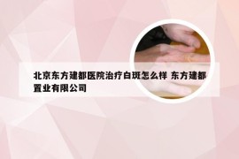 北京东方建都医院治疗白斑怎么样 东方建都置业有限公司