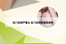 肛门白斑严重么 肛门白斑就是癌症吗