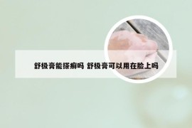 舒极膏能搽癣吗 舒极膏可以用在脸上吗