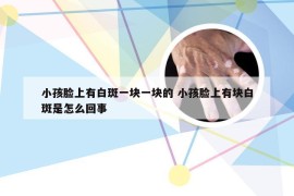 小孩脸上有白斑一块一块的 小孩脸上有块白斑是怎么回事