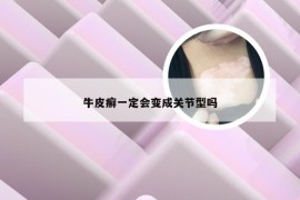 牛皮癣一定会变成关节型吗