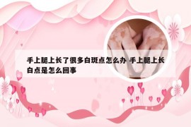 手上腿上长了很多白斑点怎么办 手上腿上长白点是怎么回事