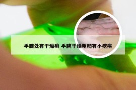 手腕处有干燥癣 手腕干燥粗糙有小疙瘩