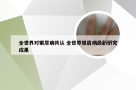 全世界对银屑病共认 全世界银屑病最新研究成果