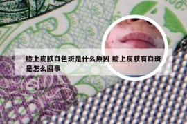 脸上皮肤白色斑是什么原因 脸上皮肤有白斑是怎么回事