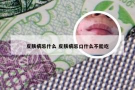 皮肤病忌什么 皮肤病忌口什么不能吃