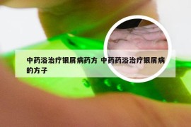 中药浴治疗银屑病药方 中药药浴治疗银屑病的方子