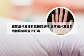 银屑病并发症包括糖尿病吗 银屑病并发症包括糖尿病吗能治好吗