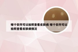 哪个软件可以拍照查看皮肤病 哪个软件可以拍照查看皮肤病情况