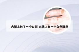 大腿上长了一个白斑 大腿上有一个白色斑点