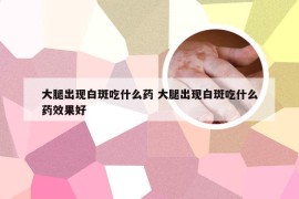 大腿出现白斑吃什么药 大腿出现白斑吃什么药效果好