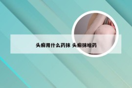 头癣用什么药抹 头癣抹啥药