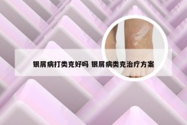 银屑病打类克好吗 银屑病类克治疗方案